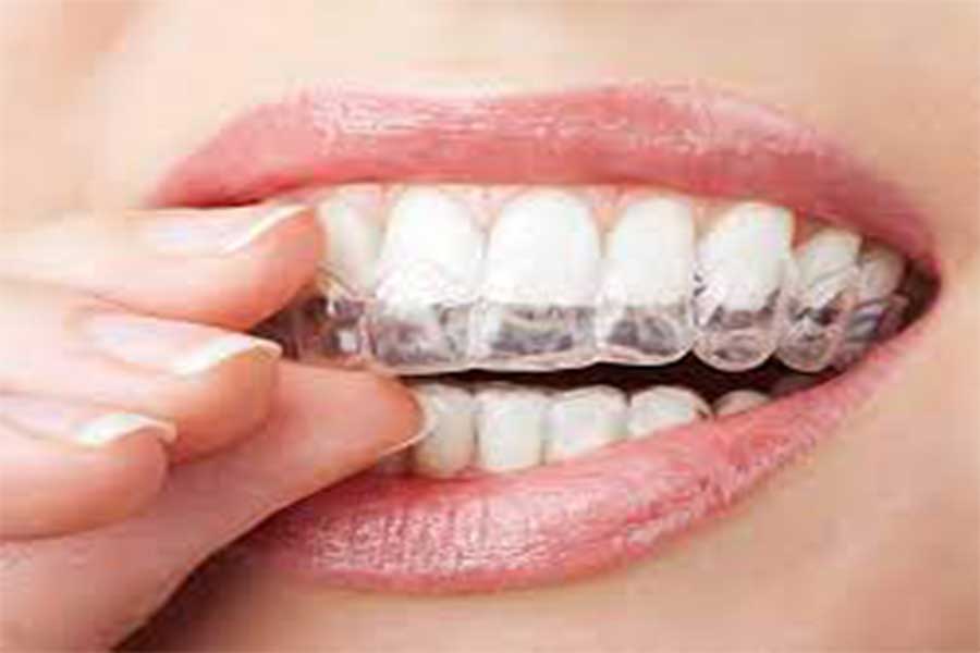 Digital orthodontics