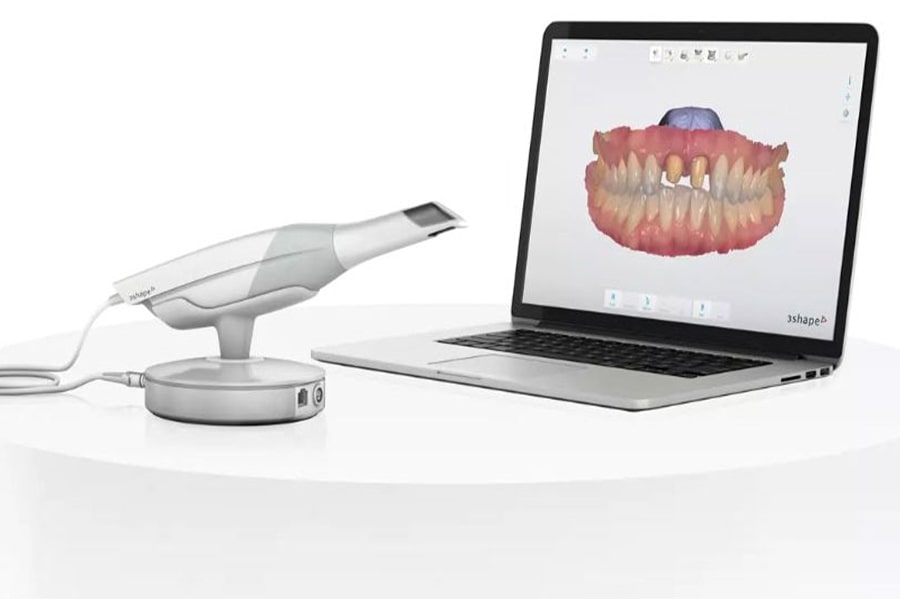 How do digital dental scanners work?