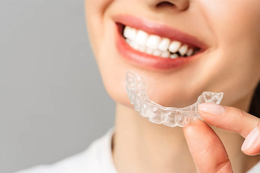 Advantages of Using Aligners Compared to Traditional Braces in Orthodontics