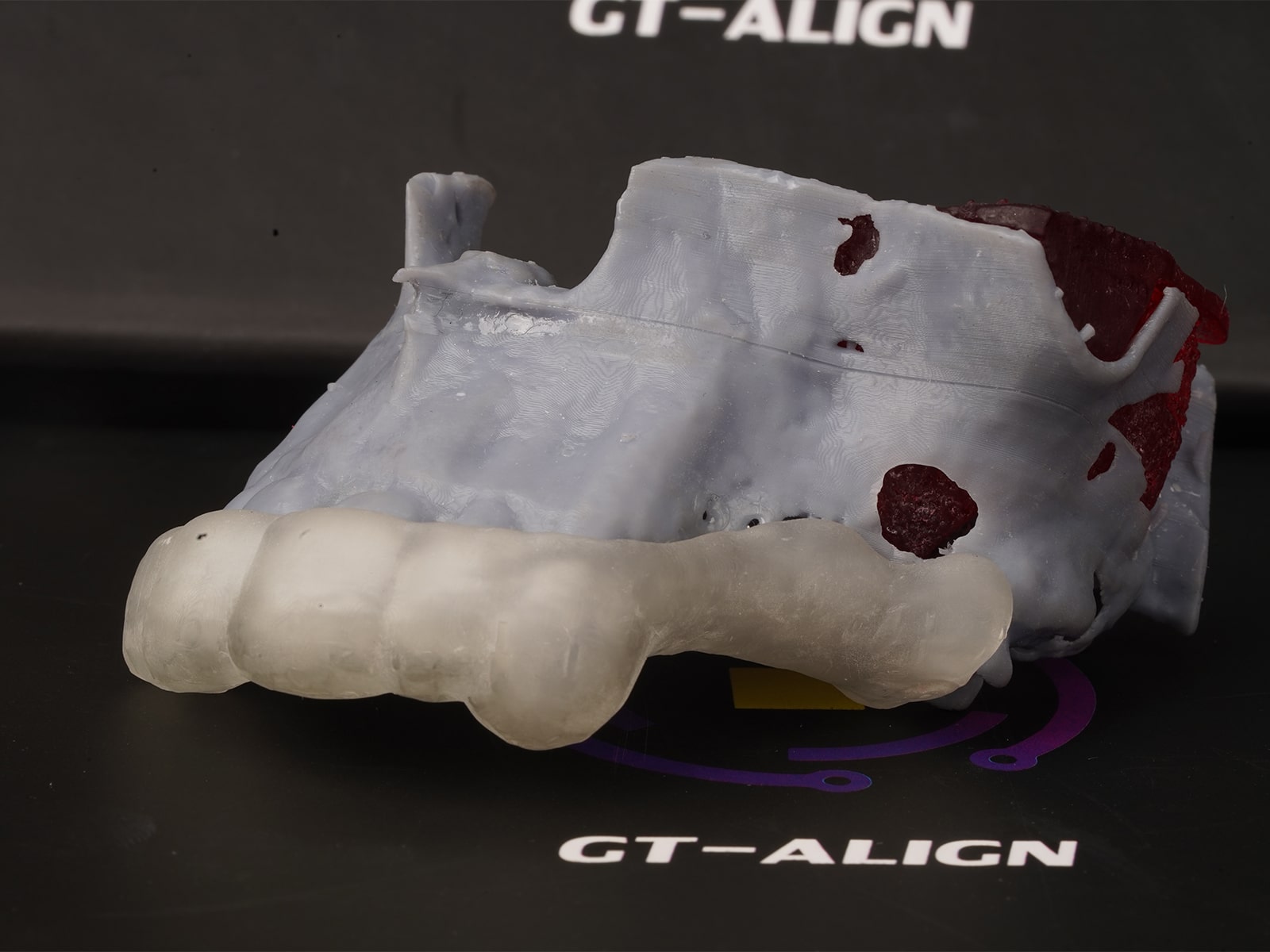 Implant Surgical Guide