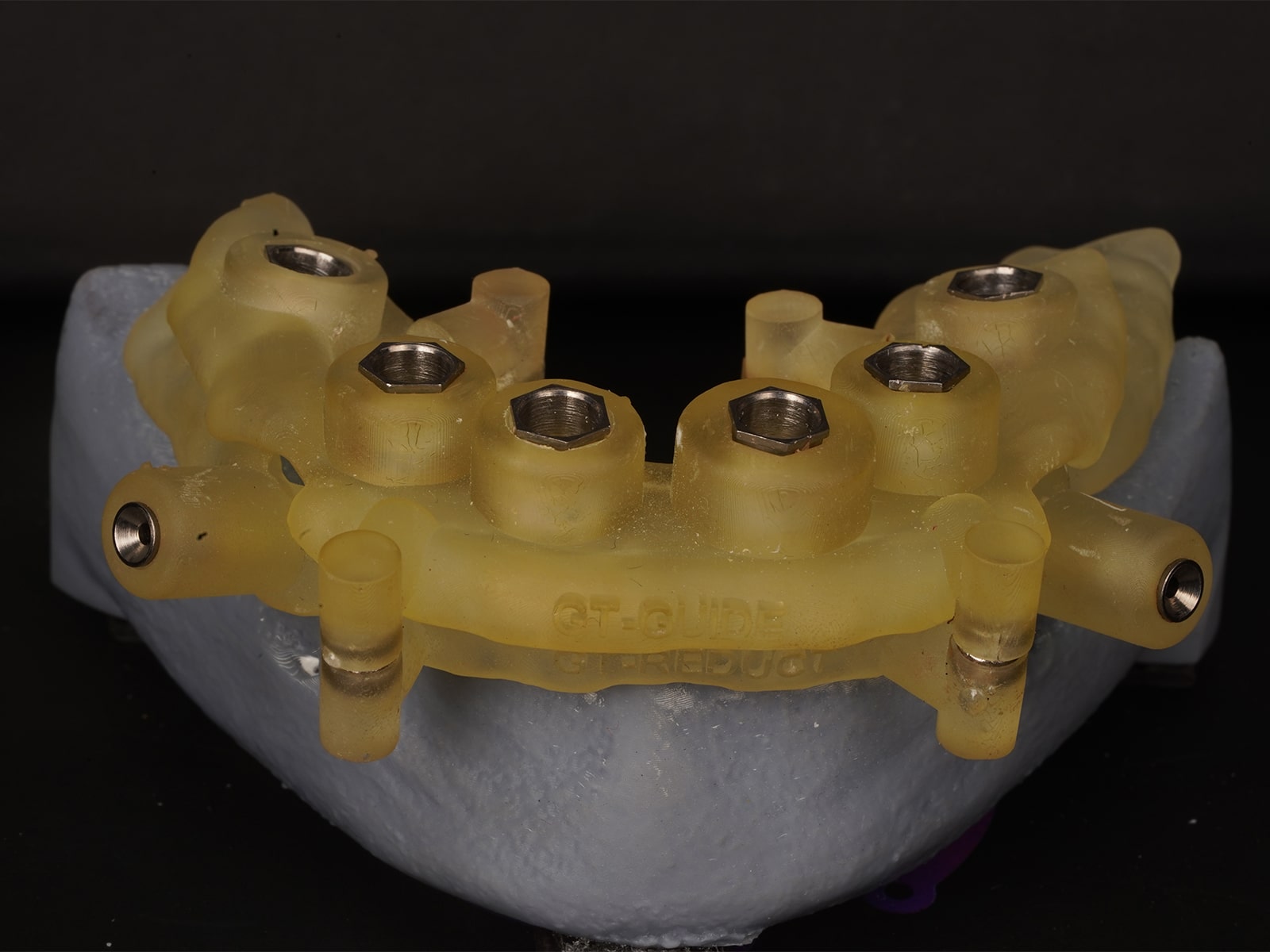 Chirurgische Führung Reduct