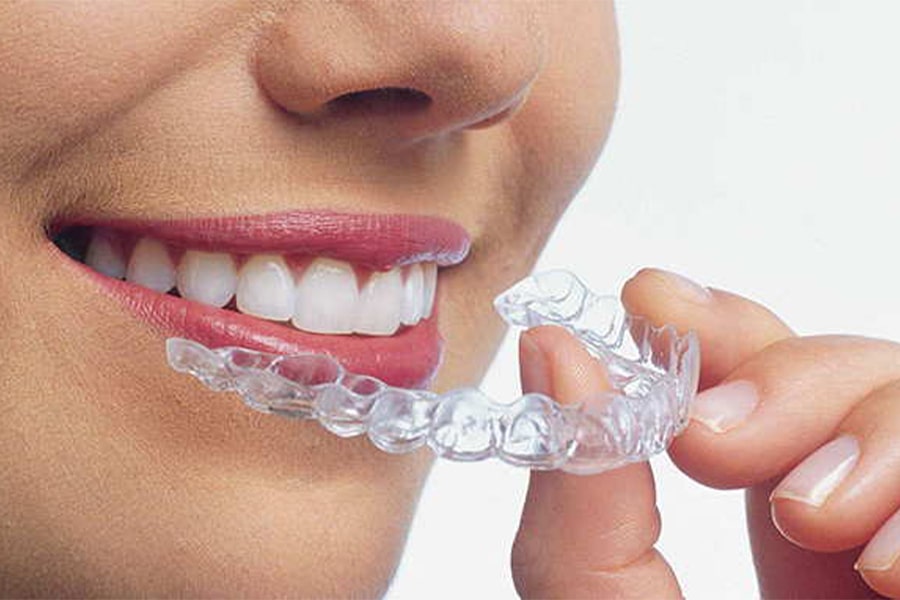 نایت گارد محافظت از دندان‌ها در برابر ساییدگی شبانه