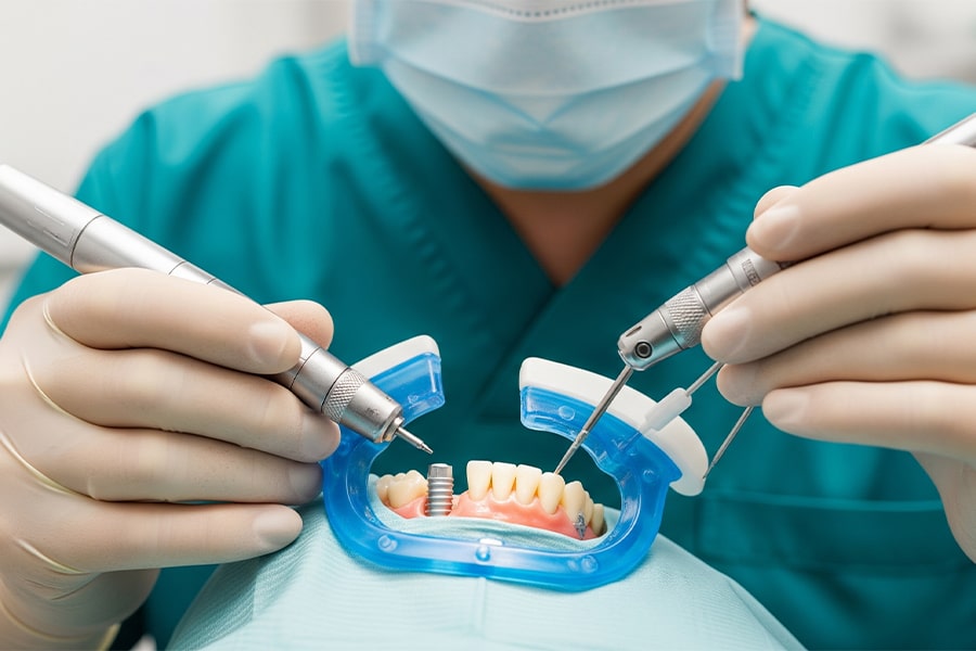 نقش گاید جراحی در ایمپلنت‌های دندانی