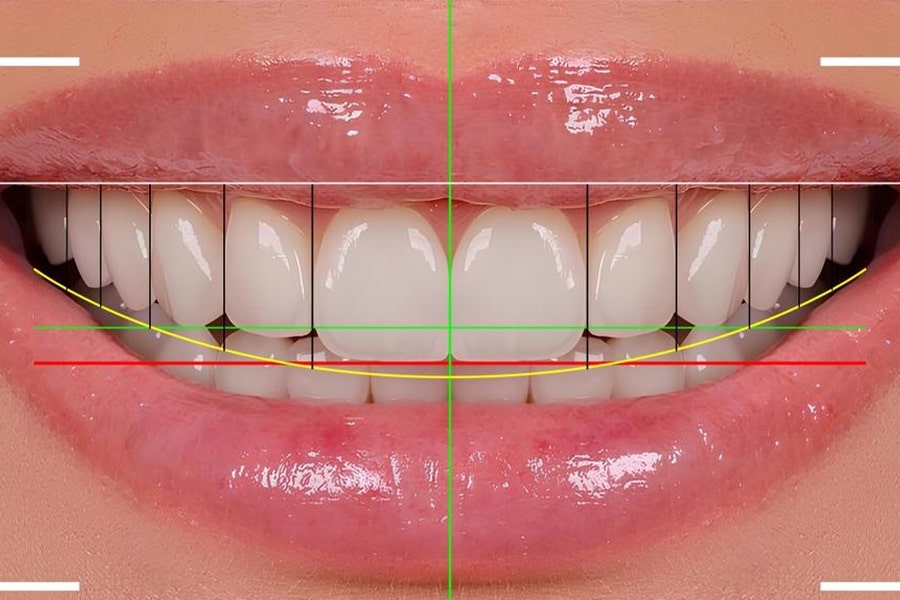 طراحی دیجیتال لبخند؛ نقطه عطفی در دندانپزشکی دیجیتال