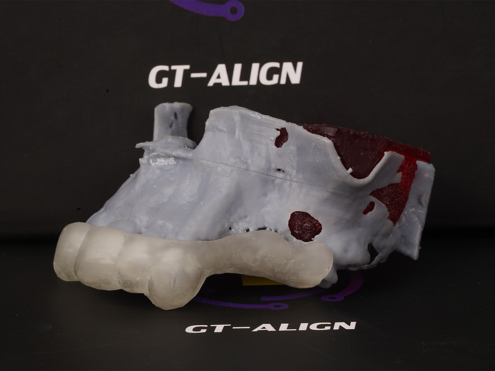 گاید جراحی ایمپلنت